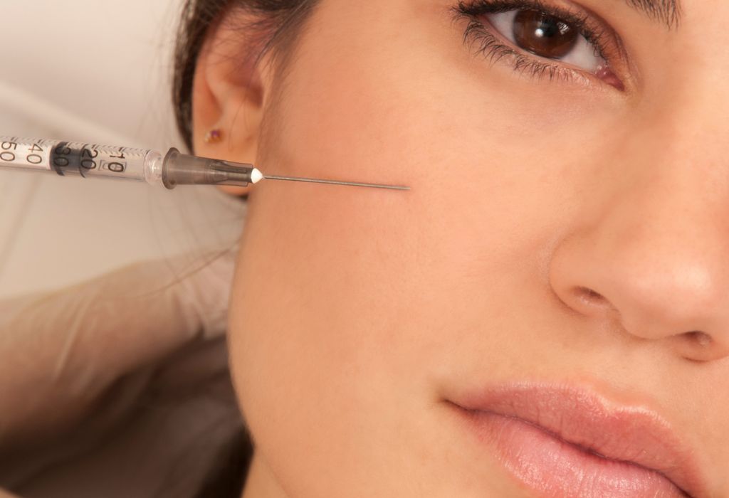 Botox Treatment for Bunny Lines in Wirral by SJS Aesthetics 2